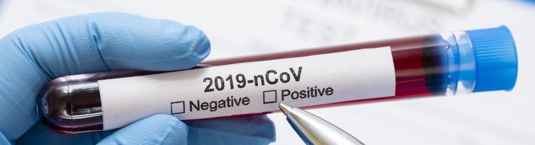 "No BS"​ view how coronavirus (COVID-19) affects the language industry - Part I
